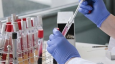 Россия направила в Бишкек еще 10 тысяч тест-систем для выявления коронавируса