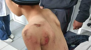 Киргизский омбудсмен раскритиковал суд за решение по делу о пытке ребенка автомобилем