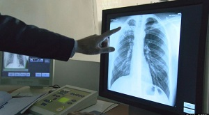 Две несовместимые вещи: детство и онкология в Таджикистане