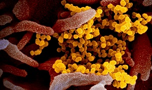 Китай. Лакомились мышами или экспериментировали с их инфекциями?