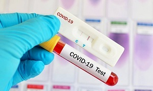 Россия подарила Кыргызстану 30 тысяч тест-систем для диагностики коронавируса