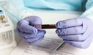 В Кыргызстане 30,8% населения имеют антитела к вирусу COVID-19