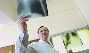 Симптомы долгого ковида выявлены у 15 миллионов человек