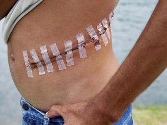 Полгода правления талибов: отчаявшиеся афганцы начали продавать себя на органы