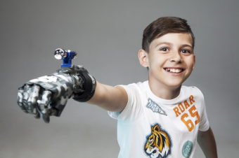 Российская компания планирует полностью обеспечить людей с инвалидностью в Узбекистане современными киберпротезами