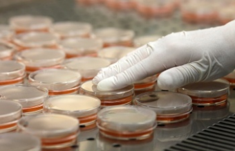 Биолаборатории США в Кыргызстане работают над сибирской язвой?