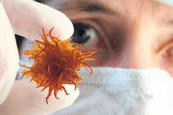 Рак в Таджикистане: сколько заболевших и где можно пройти полное обследование? 